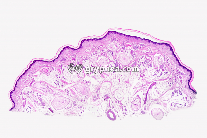 Peau du doigt avec corpuscule de Pacini x2 - gryphea.com
